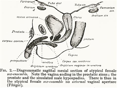 On The Atypical Male And Female Sex Ensemble So Called Hermaphroditism And Pseudo