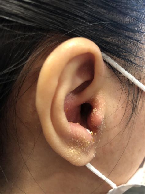 He had no special game plan and said he would just play it by ear. find more words! ENT infections in Covid-19 times | ENT Specialist Singapore