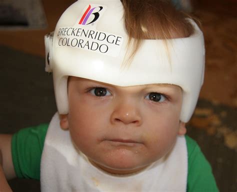 Is The Head Round Baby Helmets May Help Flat Head Syndrome Babyscience