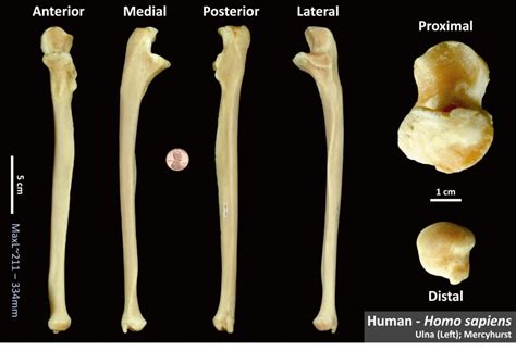 Bones Osteoid Bone Identification