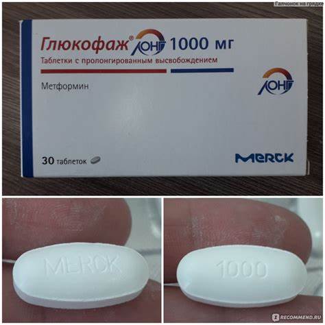 Merck Serono Глюкофаж / 1000 мг - «Неоднозначные впечатления от приема Картинка - Merck Serono Глюкофаж / 1000 мг - «Неоднозначные впечатления от приема