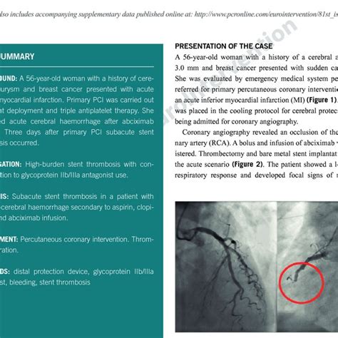 Inferior Acute Myocardial Infarction Download Scientific Diagram