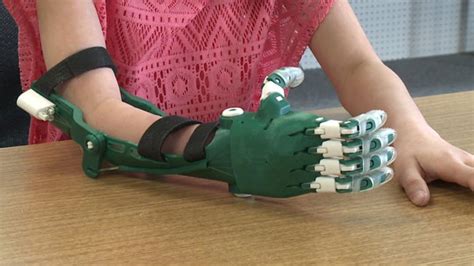 How 3d Printed Prosthetics Can Change The Lives Of Millions Of Amputees