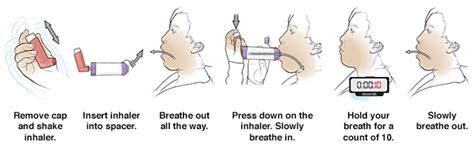 Ecg changes have also been reported. Discharge Instructions: Using a Metered-Dose Inhaler