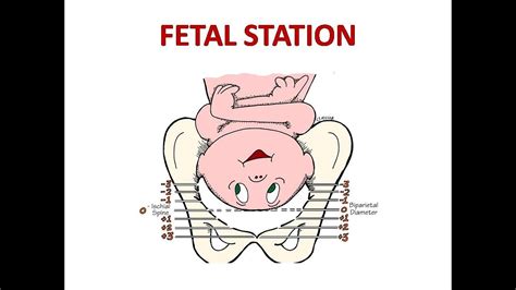 Fetal Head Station Youtube