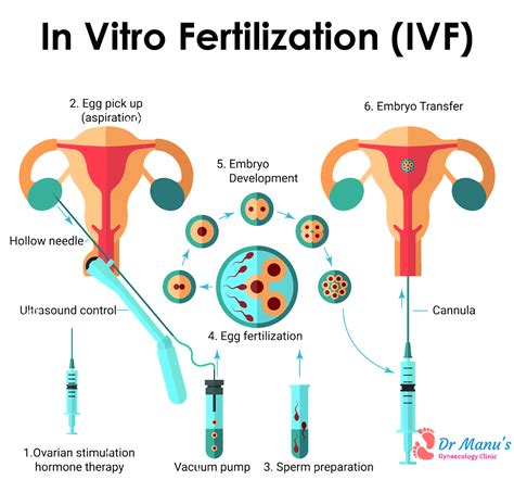 Best Hospital For Ivf Treatment Chennai Archives Best Gynecology Speciality Hospital In