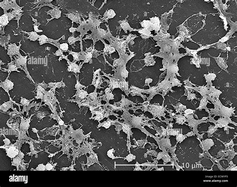 Electron Micrograph Showing Staphylococcus Aureus Bacteria Stock Photo