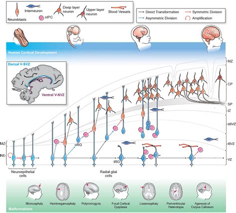 Frontiers Cortical Malformations Lessons In Human Brain Development