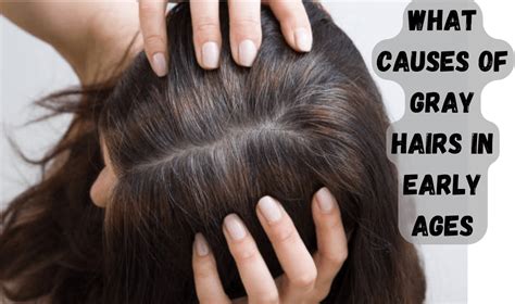 Reasons Why Causes Of Gray Hairs In Early Ages