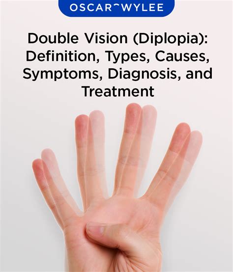 Double Vision Diplopia Definition Types Causes Symptoms