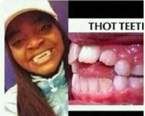 Thot Teeth Asl Lol Instagram Posts