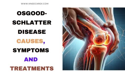 Osgood Schlatter Disease Causes Symptoms Best Treatments
