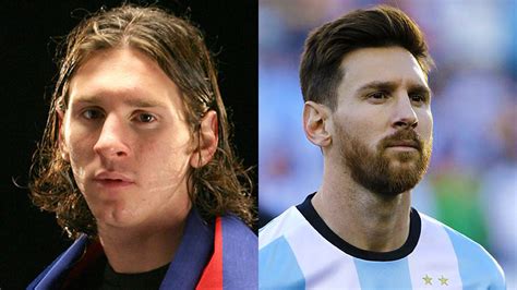 Lionel Messi Estos Son Los Arreglitos Que Se Hizo Según Un Cirujano