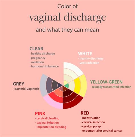 Vaginal Discharge Pictures