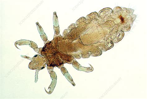 Human Louse Stock Image C Science Photo Library