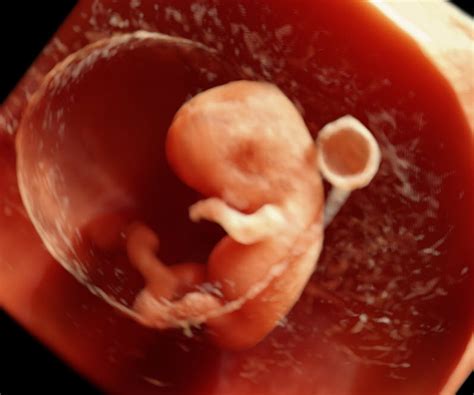 Hd Ultrasounds 4d Imaging Of Your Unborn Child Is The Future Time