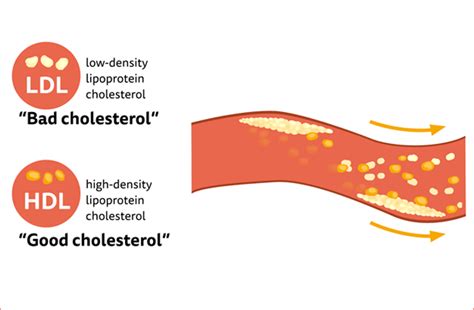 Scientific Concept Good Vs Bad Cholesterol