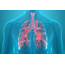 Lung Problems Items That Can Damage Your Lungs  The Healthy