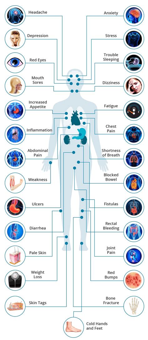 Crohn’s Disease: Why Do I Feel This Way?