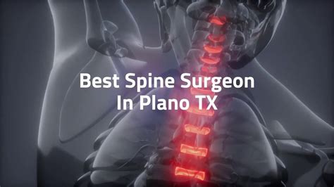 Best Spine Surgeon In Plano TX Dr Scott Kutz Plano TX YouTube