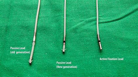 Meaning of bipolar device both electrons and holes leads to current unlike fet where either electron or hole causes current. Basics of Pacing Leads - How to Pace