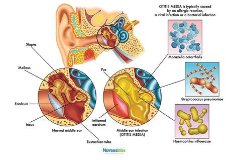 Pin Op Nursing School And Study Guides