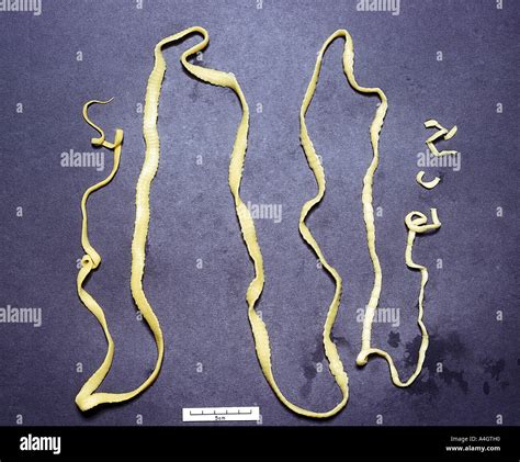 A Photograph Of The Taenia Tapeworm Stock Photo Alamy