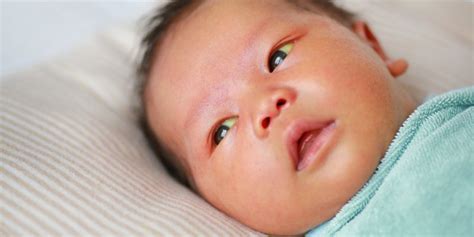 Prolonged Jaundice In Newborn What You Need To Know
