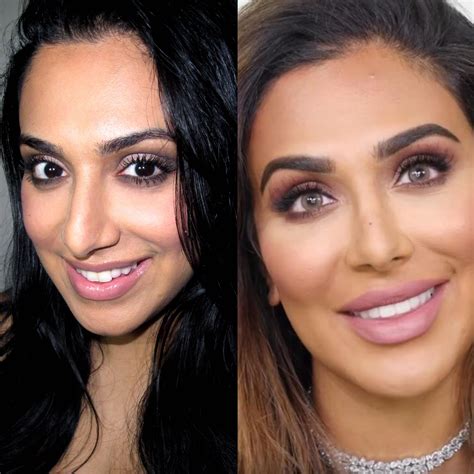 Huda Beauty Before And After Plastic Surgery