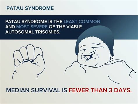 Apa Itu Patau Syndrome
