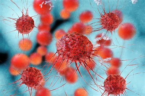 Cervical Cancer Breakthrough Major New Clue To Better Understanding