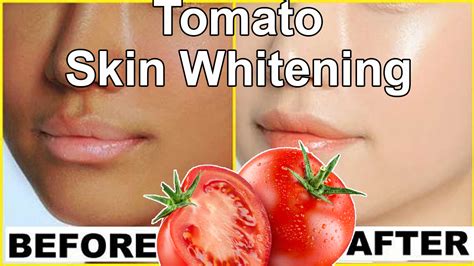 Pin On Skin Whitening At Home Remedies