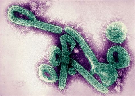 Johnson ed, johnson bk, silverstein d, et al. Marburg virus transmission, disease, symptoms, diagnosis ...