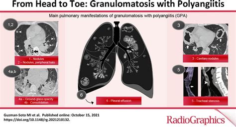 From Head To Toe Granulomatosis With Polyangiitis Radiographics