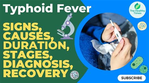 Typhoid Fever What You Need To Know Signs Symptoms Causes Stages