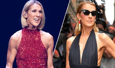 Céline Dion’s Major Weight Loss Celine Dion Affected By An Incurable Disease The Singer Admits