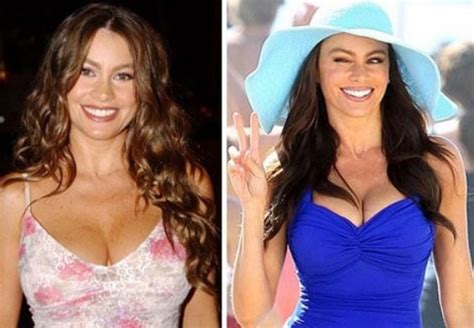 Updated Sofia Vergara Plastic Surgery Before After