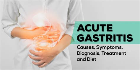 Acute Gastritis Causes Symptoms Diet And More