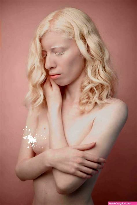Mexican Albino Model Is Changing Beauty Standards Hot Sex Picture