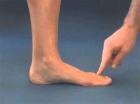 It is the terminal portion of a limb which bears weight and allows locomotion. Ball of foot pain and how to treat this with orthotic innersoles - YouTube