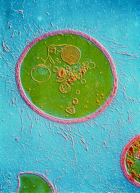 Tem Of Cryptococcus Neoformans Photograph By Cnri Pixels