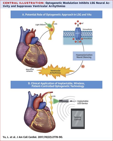 Optogenetic Modulation Of Cardiac Sympathetic Nerve Activity To Prevent