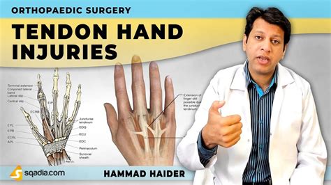 Tendon Hand Injuries Flexor And Extensor Orthopaedic Surgery Lectures V Learning™ Youtube