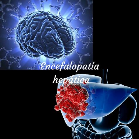 Encefalopatia Hepática Redutor De Amônia