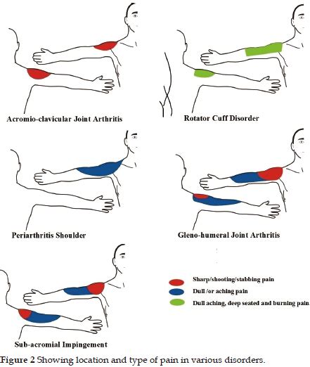 Role Of Pain Mapping In Shoulder Disorders Singh International