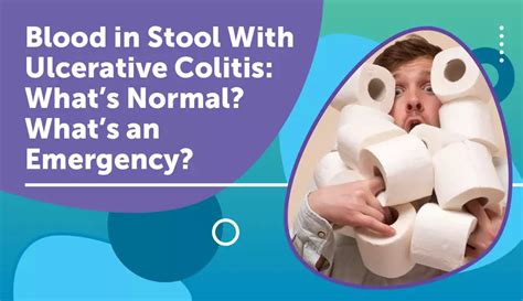 Ulcerative Colitis How Much Blood Is Too Much In Stool