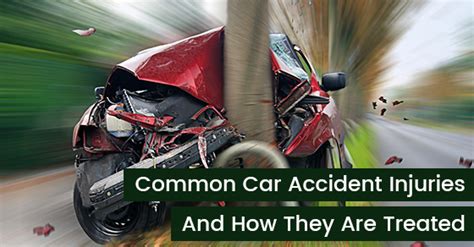 Five Common Car Accident Injuries And How They Are Treated