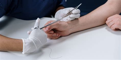 The Importance Of Stitches Why Some Wounds Require Sutures For Healing