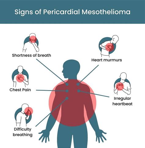 Signs And Symptoms Of Mesothelioma Miami Herald