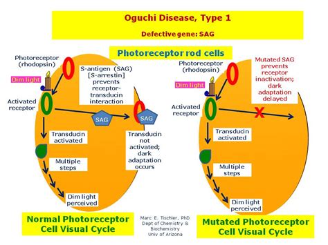 Oguchi Disease Type 1 Hereditary Ocular Diseases
